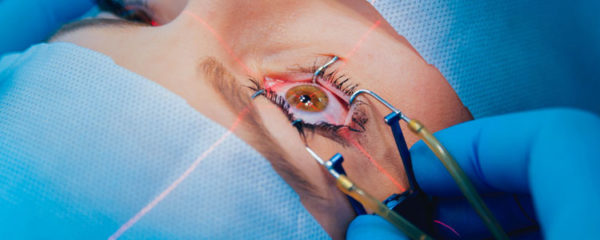 chirurgie ophtalmologique