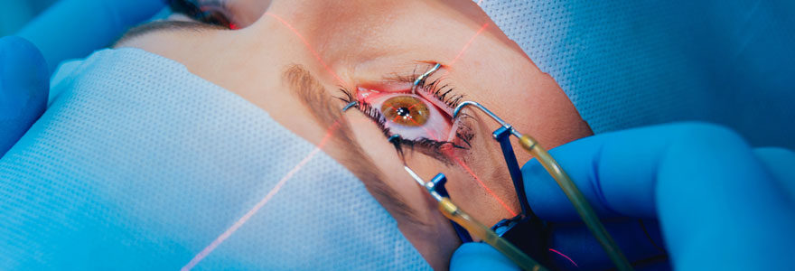 chirurgie ophtalmologique